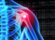 SST : Le point sur les diagnostics et les traitements des troubles à l’épaule