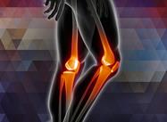 Rehabilitation of Workers with Knee Osteoarthritis