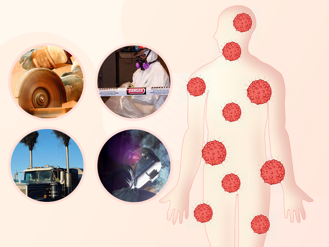 Le fardeau des cancers d’origine professionnelle