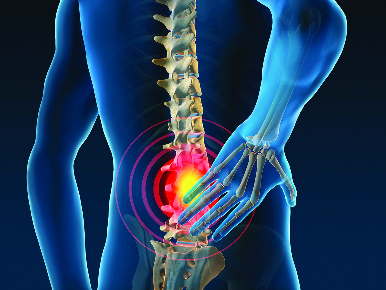 Nouvelle approche de prédiction des chargements au dos 
