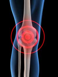Réadaptation des travailleurs atteints de l’arthrose du genou 